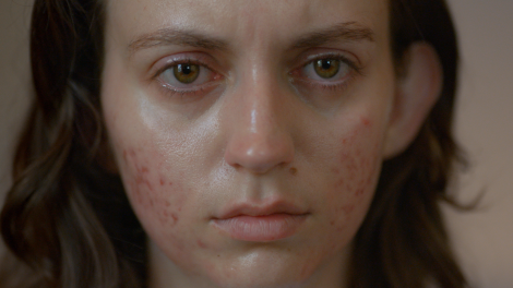 BETC pour La Roche Posay – « Beyond Skin » 